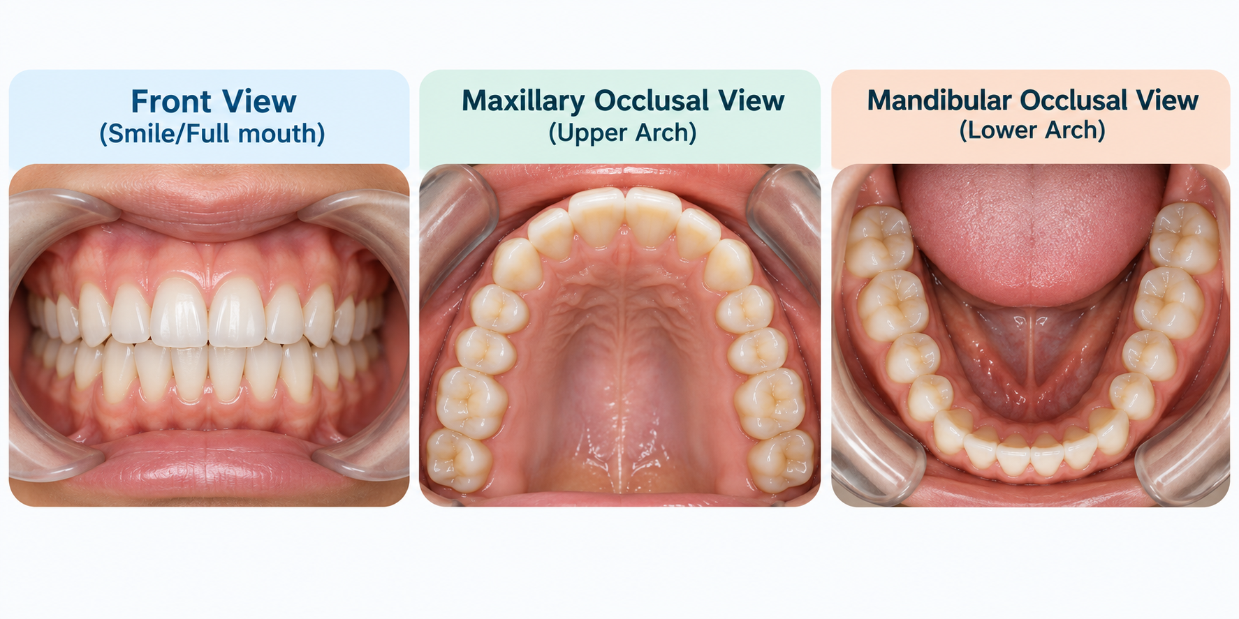 Three dental photo views: front smile, upper arch, and lower arch.
